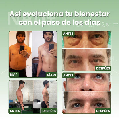 NAD+ Resveratrol