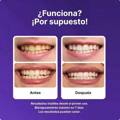 Tiras Blanqueadoras Dr.Dent